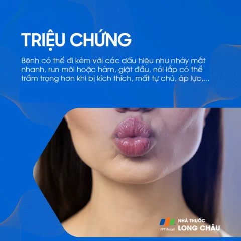 Tự Nhiên Bị Nói Lắp: Hiểu Rõ Nguyên Nhân và Phương Pháp Hỗ Trợ Toàn Diện