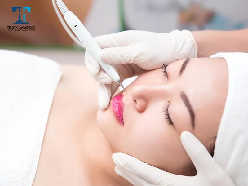 Quy trình cách sử dụng máy 5 in 1 để đốt nốt ruồi và xóa tàn nhang an toàn, không gây chảy máu, mang lại làn da đều màu.