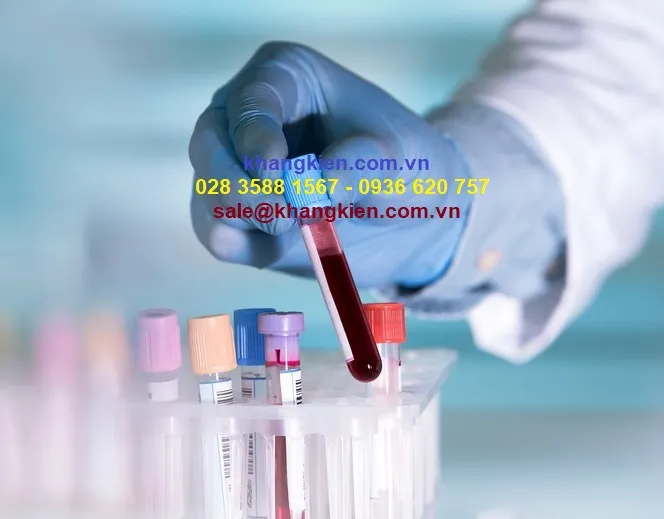 Cách sử dụng máy ly tâm kiểm tra ống ly tâm