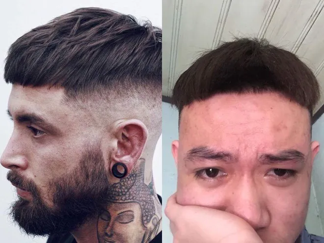 Người đàn ông đang cố gắng che đi mái tóc cắt lỗi, cần sự tư vấn