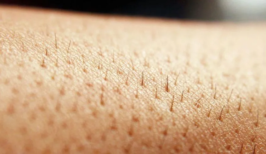 Lông mọc lại sau triệt, giải thích các lý do có thể như lông ở giai đoạn chuẩn bị mọc hoặc sai kỹ thuật trong cách sử dụng máy triệt lông mini.