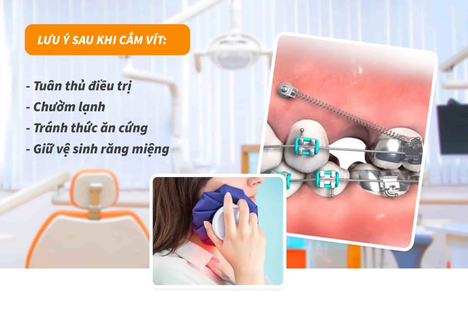 Lưu ý sau gắn vít khi niềng răng 