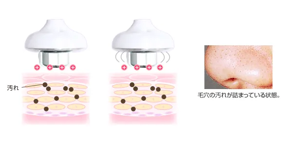 Hình ảnh mô tả công nghệ làm sạch bằng ION của máy chăm sóc da Belulu Classy