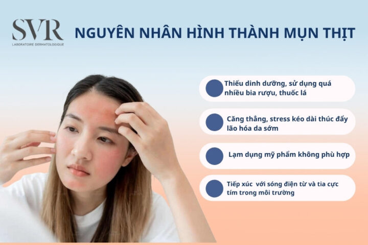 Làm Sao Để Mụn Tự Lắp Thịt: Hiểu Rõ Về Sự Hình Thành Và Phát Triển Của Mụn Thịt