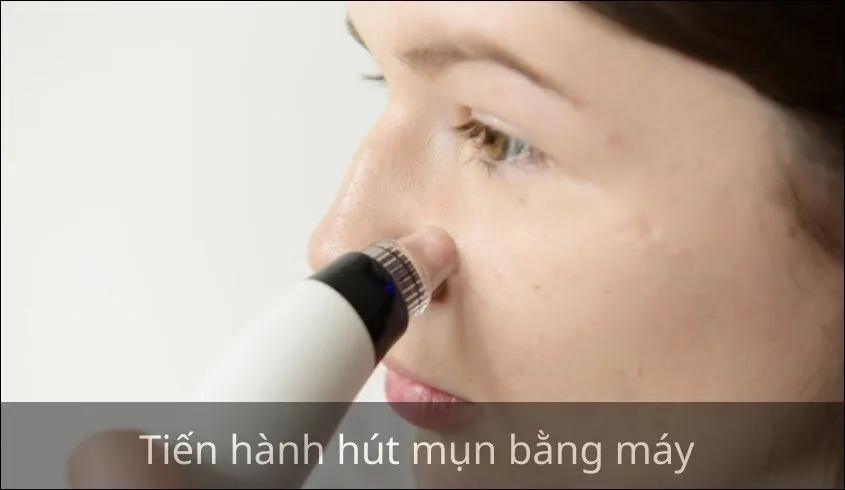 Tiến hành hút mụn đúng cách sử dụng máy hút mụn bằng cách di chuyển đều